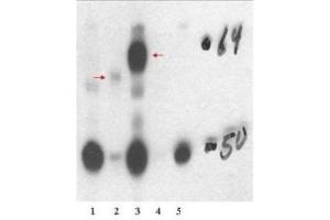 Western Blotting (WB) image for anti-Thyroid Hormone Receptor, beta (THRB) (Isoform 1), (N-Term) antibody (ABIN964895) (THRB antibody  (Isoform 1, N-Term))