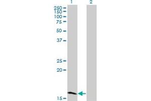 Western Blot analysis of ZNF44 expression in transfected 293T cell line by ZNF44 monoclonal antibody (M01), clone 4E2. (Zinc Finger Protein 44 antibody  (AA 1-103))