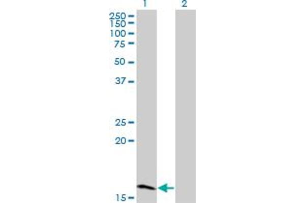 Zinc Finger Protein 44 抗体  (AA 1-103)