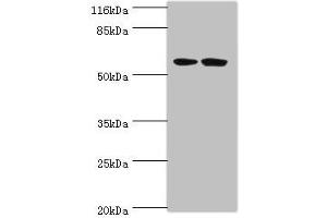Western blot All lanes: DCAF4 antibody at 2 μg/mL Lane 1: 293T whole cell lysate Lane 2: Hela whole cell lysate Secondary Goat polyclonal to rabbit IgG at 1/10000 dilution Predicted band size: 56, 49, 45, 55 kDa Observed band size: 56 kDa (DCAF4 antibody  (AA 1-495))