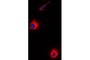 Immunofluorescent analysis of USP30 staining in HeLa cells.