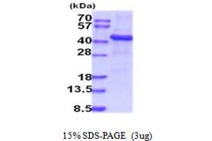 SDS-PAGE (SDS) image for Tyrosylprotein Sulfotransferase 1 (TPST1) (AA 26-370) protein (His tag) (ABIN5854166)