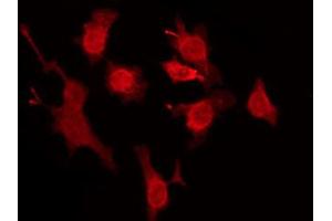ABIN6274477 staining Hela by IF/ICC. (FAM84B antibody  (N-Term))