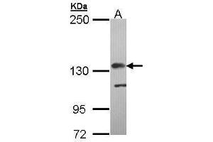 WB Image Sample (30 ug of whole cell lysate) A: Molt-4 , 5% SDS PAGE antibody diluted at 1:5000 (Complement Factor H antibody)