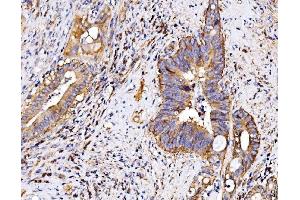 IHC analysis of P2X7/P2RX7 using anti-P2X7/P2RX7 antibody (ABIN7601815).