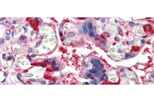 Immunohistochemistry (IHC) image for anti-Lactate Dehydrogenase B (LDHB) (C-Term) antibody (ABIN2783283)