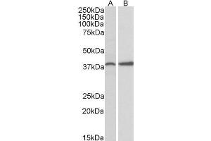 ABIN571043 (0. (PRKCDBP antibody  (Internal Region))