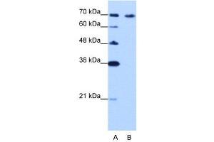 WB Suggested Anti-CARF  Antibody Titration: 0. (CDKN2AIP antibody  (C-Term))