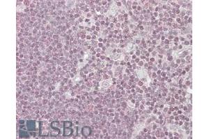 ABIN185050 (3. (PPP1R8 antibody  (C-Term))
