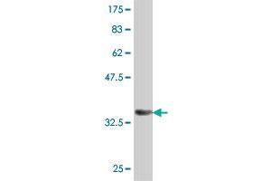 Western Blotting (WB) image for anti-ATP-Binding Cassette, Sub-Family F (GCN20), Member 1 (ABCF1) (AA 642-739) antibody (ABIN559733)
