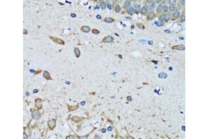 Immunohistochemistry of paraffin-embedded Mouse brain using FDFT1 Polyclonal Antibody at dilution of 1:100 (40x lens). (FDFT1 antibody)