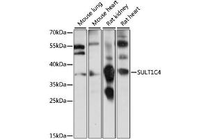 Western blot analysis of extracts of various cell lines, using SULT1C4 antibody (ABIN6293706) at 1:1000 dilution. (SULT1C4 antibody)