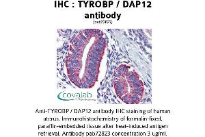 Image no. 2 for anti-TYRO Protein tyrosine Kinase Binding Protein (TYROBP) (Internal Region) antibody (ABIN1740506) (TYROBP antibody  (Internal Region))