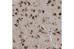 Immunohistochemical staining (Formalin-fixed paraffin-embedded sections) of human cerebral cortex with IL1RL2 polyclonal antibody  shows strong cytoplasmic positivity in neuronal cells at 1:50-1:200 dilution. (IL1RL2 antibody)