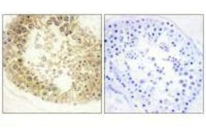 Immunohistochemistry analysis of paraffin-embedded human testis tissue, using ECRG4 antibody. (MEMO1 antibody)