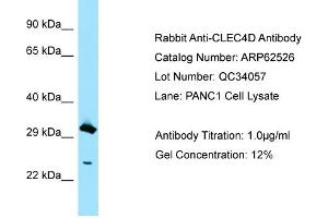 Western Blotting (WB) image for anti-C-Type Lectin Domain Family 4, Member D (CLEC4D) (C-Term) antibody (ABIN2789169) (CLEC4D antibody  (C-Term))