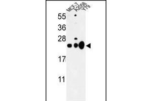 Western blot analysis of CBX1 Antibody (C-term) (ABIN652861 and ABIN2842560) in MCF-7, , Y79 cell line lysates (35 μg/lane). (CBX1 antibody  (C-Term))