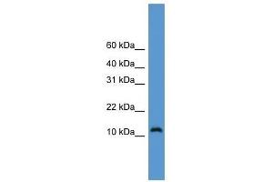 Western Blot showing CDC26 antibody used at a concentration of 1-2 ug/ml to detect its target protein. (CDC26 antibody  (Middle Region))