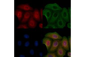 ABIN6257097 and ABIN6275838 staining Hela cells by IF/ICC. (Casein Kinase 1 delta antibody  (Internal Region))