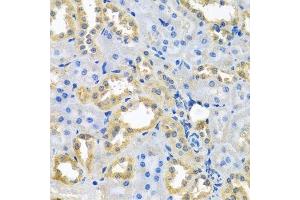 Immunohistochemistry of paraffin-embedded rat kidney using NDUFB10 antibody. (NDUFB10 antibody  (AA 1-172))