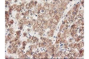 Immunohistochemical staining of paraffin-embedded Human liver tissue using anti-CYP2J2 mouse monoclonal antibody. (CYP2J2 antibody)