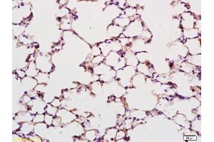 Formalin-fixed and paraffin embedded rat lung labeled with Anti Phospho-SEK1/MKK4 (Thr261) Polyclonal Antibody, Unconjugated (ABIN702745) at 1:200 followed by conjugation to the secondary antibody and DAB staining