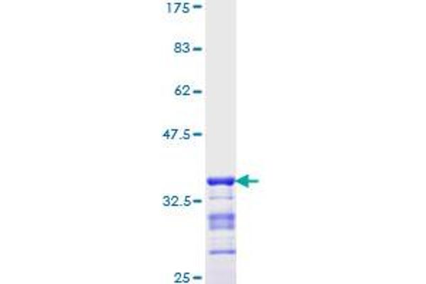 NKX2-1 Protein (AA 56-147) (GST tag)