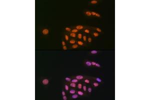 Immunofluorescence analysis of U-2 OS cells using K/MYST1/MOF Rabbit mAb (ABIN7268063) at dilution of 1:100 (40x lens). (MYST1 antibody)