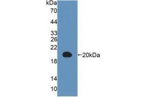 Detection of Recombinant MAP1LC3a, Human using Polyclonal Antibody to Microtubule Associated Protein 1 Light Chain 3 Alpha (MAP1LC3a) (MAP1LC3A antibody  (AA 1-120))