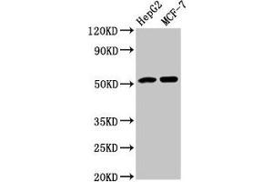 Western Blot Positive WB detected in: HepG2 whole cell lysate, MCF-7 whole cell lysate All lanes: AGT antibody at 3. (AGT antibody  (AA 44-427))