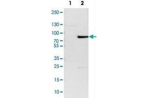 Western Blot analysis of Lane 1: NIH-3T3 cell lysate (mouse embryonic fibroblast cells) and Lane 2: NBT-II cell lysate (Wistar rat bladder tumor cells) with ZBTB7B polyclonal antibody . (ZBTB7B antibody)