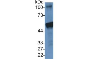 Detection of CK10 in Human A431 cell lysate using Polyclonal Antibody to Cytokeratin 10 (CK10) (Keratin 10 antibody  (AA 153-456))