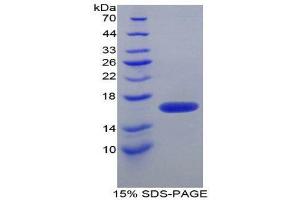 SDS-PAGE (SDS) image for FK506 Binding Protein 1B, 12.6 KDa (FKBP1B) (AA 2-108) protein (His tag) (ABIN1079572) (FKBP1B Protein (AA 2-108) (His tag))