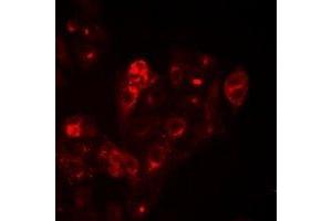 Immunofluorescent analysis of HAI-1 staining in Hela cells. (SPINT1 antibody)