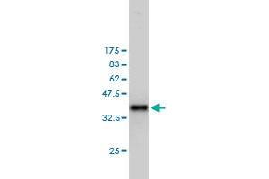 Western Blot detection against Immunogen (36. (PTTG1 antibody  (AA 1-100))