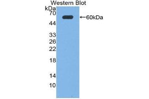 Western Blotting (WB) image for anti-Neuronal Pentraxin 1 (NPX1) (AA 115-364) antibody (ABIN1869514) (NPX1 antibody  (AA 115-364))