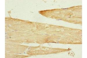 Immunohistochemistry of paraffin-embedded human skeletal muscle tissue using ABIN7170343 at dilution of 1:100 (SAMM5 (AA 1-220) antibody)