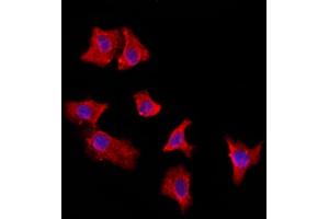 ABIN6264959 and ABIN6272887 staining HepG2 by IF/ICC. (EXOC2 antibody  (N-Term))