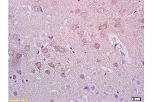 Formalin-fixed and paraffin embedded rat brain tissue with labeled Anti-Alpha-Synuclein/Syn/SNCA Polyclonal Antibody, Unconjugated  at 1:200, followed by conjugation to the secondary antibody and DAB staining (SNCA antibody  (AA 1-140))
