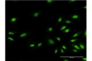 Immunofluorescence of monoclonal antibody to EHMT1 on HeLa cell. (EHMT1 antibody  (AA 1-100))