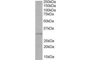ABIN184633 (1µg/ml) staining of Human Liver lysate (35µg protein in RIPA buffer). (TIRAP antibody  (C-Term))