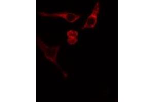 ABIN6275839 staining Hela cells by IF/ICC. (MATK antibody  (Internal Region))