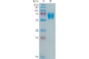 Human Protein, His Tag on SDS-PAGE under reducing condition.