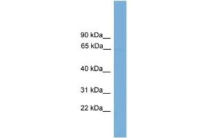 WB Suggested Anti-POLR3C Antibody Titration: 0. (POLR3C antibody  (Middle Region))