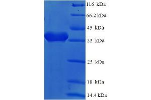 SDS-PAGE (SDS) image for CD2 (CD2) (AA 25-209) protein (His-SUMO Tag) (ABIN5709231) (CD2 Protein (CD2) (AA 25-209) (His-SUMO Tag))