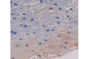 IHC-P analysis of Human Tissue, with DAB staining. (Cytokeratin 13 antibody  (AA 104-403))