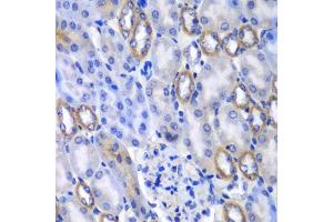 Immunohistochemistry of paraffin-embedded mouse kidney using MATK antibody  at dilution of 1:100 (40x lens). (MATK antibody  (AA 352-466))