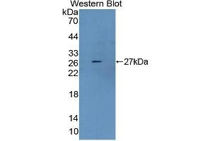 Western blot analysis of the recombinant protein. (Dystrophin antibody  (AA 3059-3314))