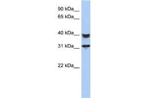 WB Suggested Anti-C5orf35 Antibody Titration: 0. (C5orf35 antibody  (N-Term))