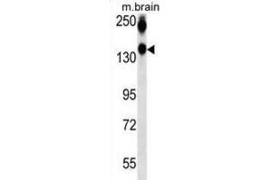 Western Blotting (WB) image for anti-Neural Cell Adhesion Molecule 1 (NCAM1) antibody (ABIN2995392)